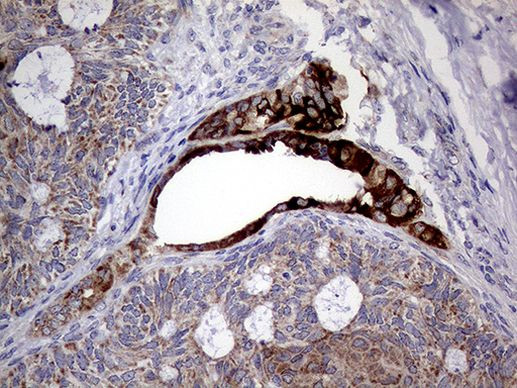 AGR2 Antibody in Immunohistochemistry (Paraffin) (IHC (P))