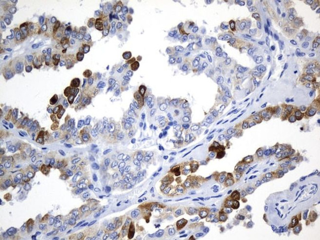 AGR2 Antibody in Immunohistochemistry (Paraffin) (IHC (P))