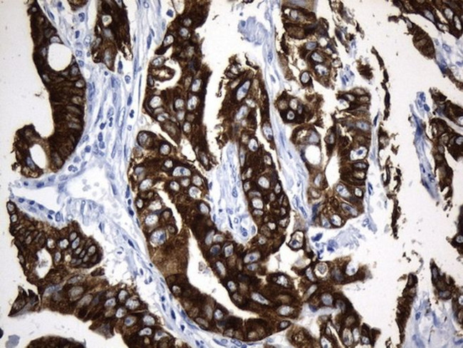 AGR2 Antibody in Immunohistochemistry (Paraffin) (IHC (P))