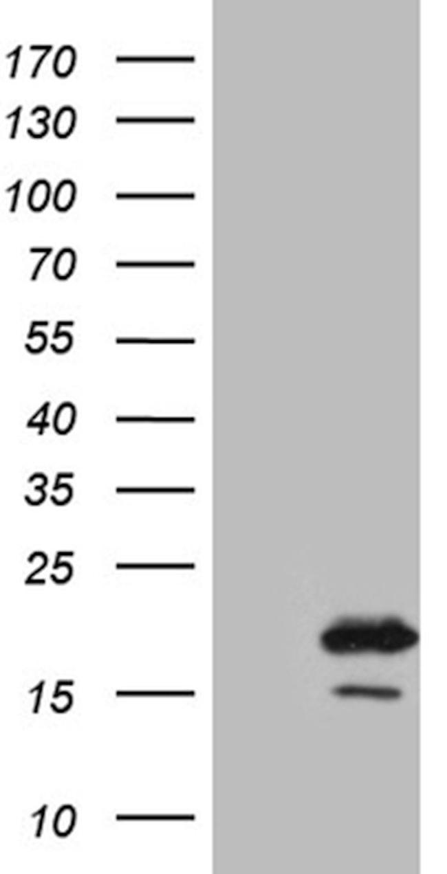 AGR2 Antibody in Western Blot (WB)