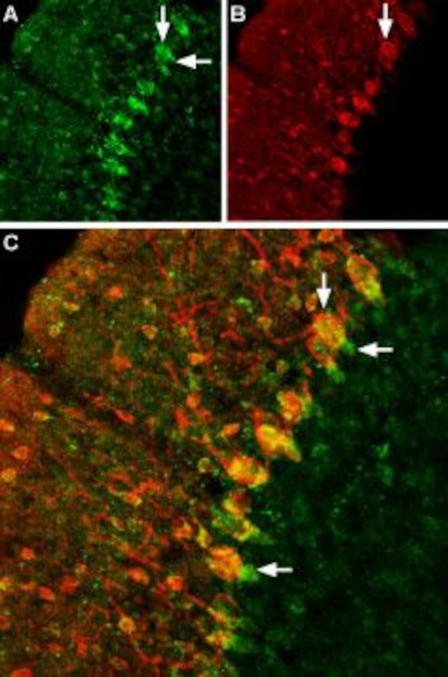 GABA Transporter 1 (GAT-1) (extracellular) Antibody in Immunohistochemistry (IHC)