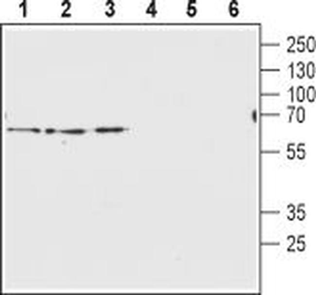 Vesicular GABA Transporter (VGAT) Antibody in Western Blot (WB)