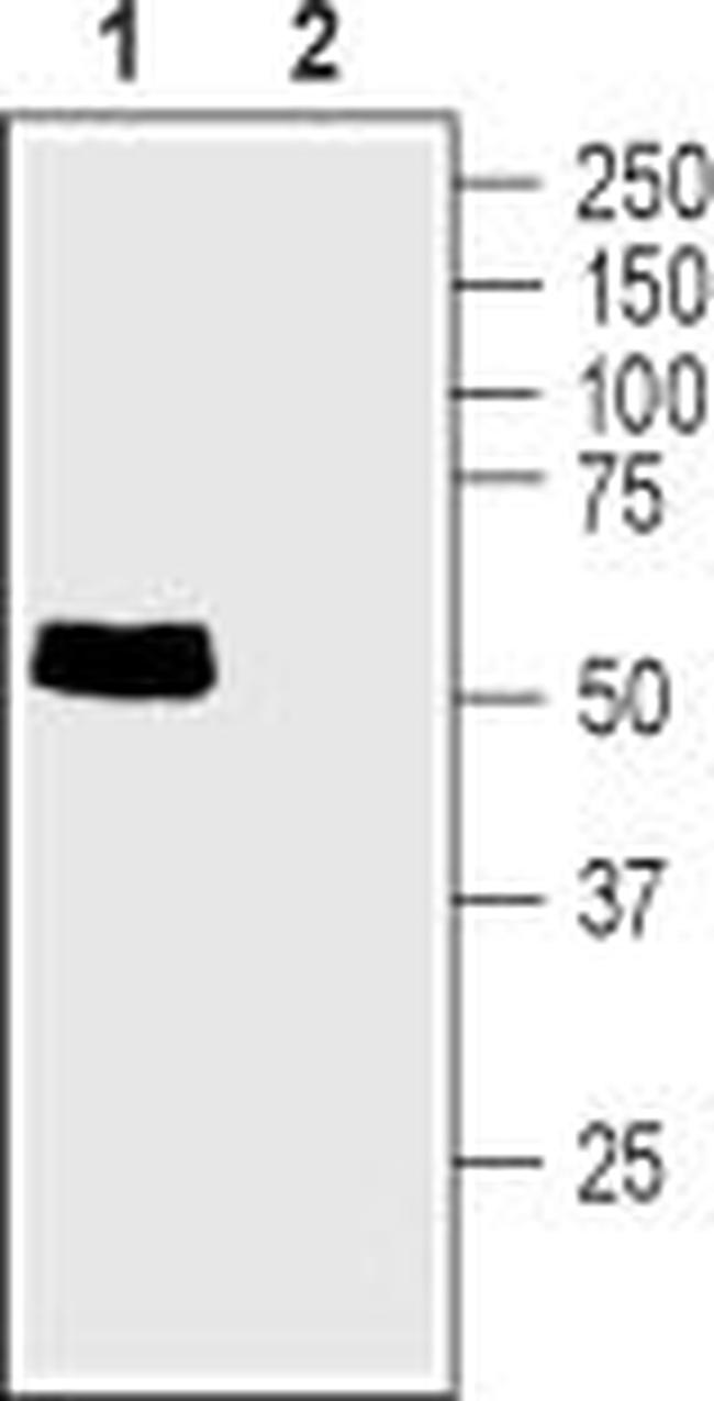Taurine Transporter (SLC6A6) Antibody in Western Blot (WB)