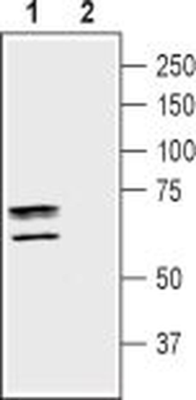 Taurine Transporter (SLC6A6) Antibody in Western Blot (WB)