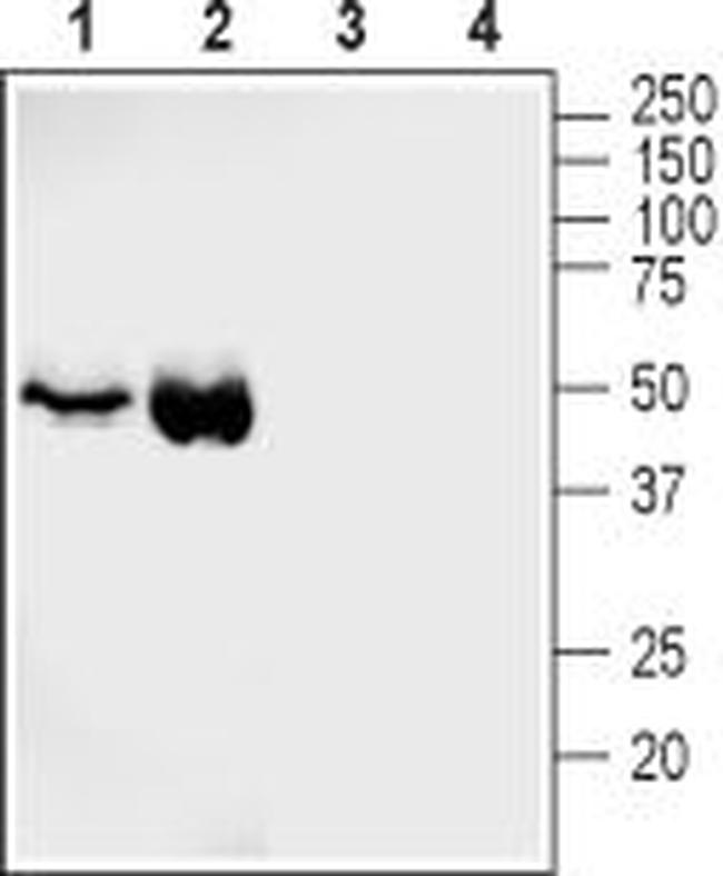 GLUT4 Antibody in Western Blot (WB)