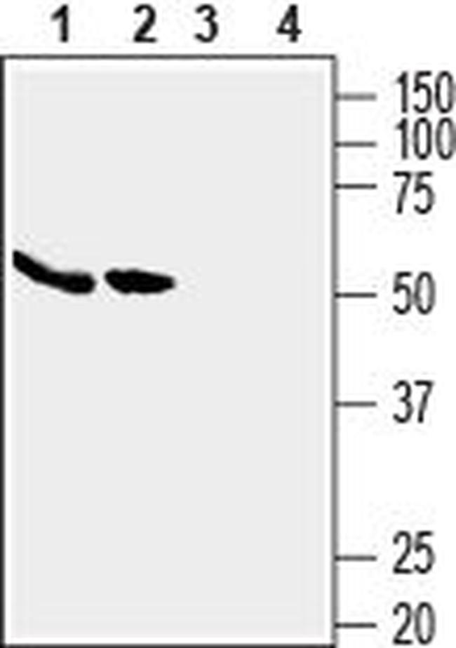 GLUT5 (SLC2A5) Antibody in Western Blot (WB)