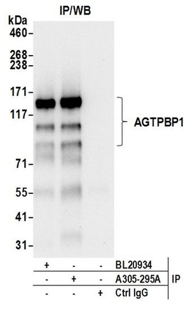 AGTPBP1 Antibody in Western Blot (WB)