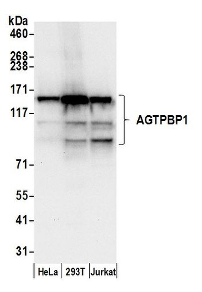 AGTPBP1 Antibody in Western Blot (WB)