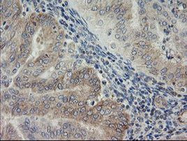 AGTPBP1 Antibody in Immunohistochemistry (Paraffin) (IHC (P))