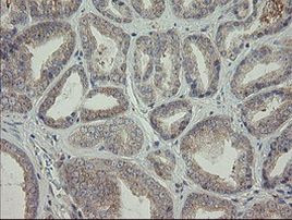 AGTPBP1 Antibody in Immunohistochemistry (Paraffin) (IHC (P))