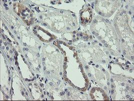 AGTPBP1 Antibody in Immunohistochemistry (Paraffin) (IHC (P))