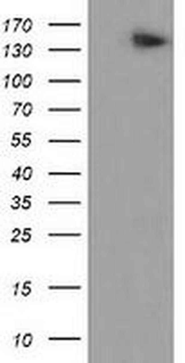 AGTPBP1 Antibody in Western Blot (WB)