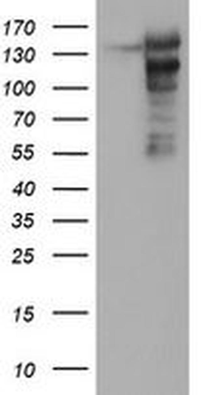 AGTPBP1 Antibody in Western Blot (WB)