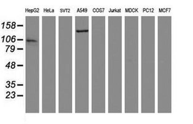 AGTPBP1 Antibody in Western Blot (WB)