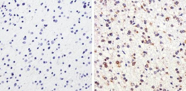 Tau Antibody in Immunohistochemistry (Paraffin) (IHC (P))