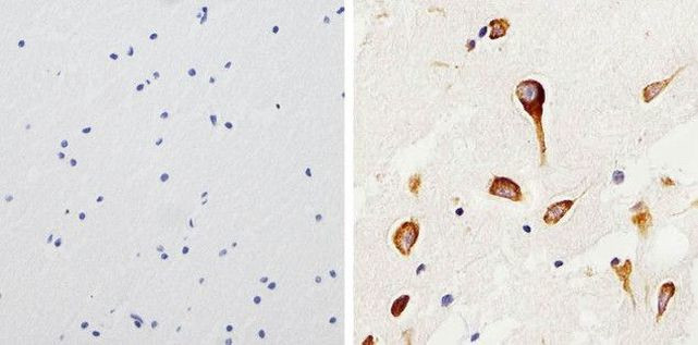 Tau Antibody in Immunohistochemistry (Paraffin) (IHC (P))