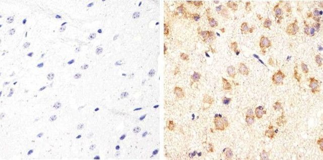 Tau Antibody in Immunohistochemistry (Paraffin) (IHC (P))