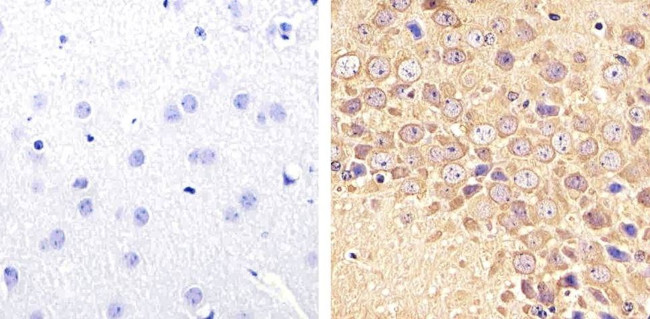 Tau (Cleaved Asp421, Asp422) Antibody in Immunohistochemistry (Paraffin) (IHC (P))