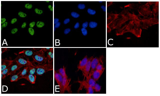 Tau (Cleaved Asp421, Asp422) Antibody in Immunocytochemistry (ICC/IF)