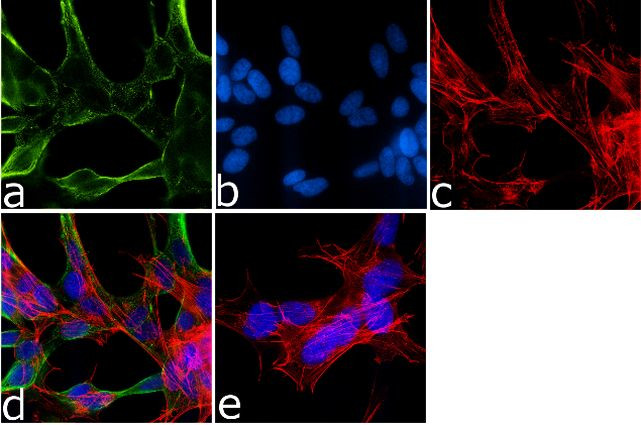 alpha Synuclein Antibody in Immunocytochemistry (ICC/IF)