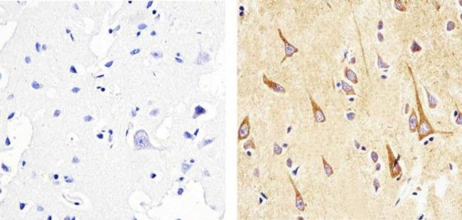 alpha Synuclein Antibody in Immunohistochemistry (Paraffin) (IHC (P))