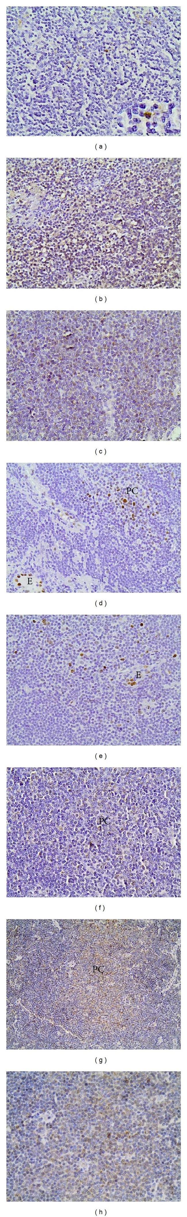 IL-8 (CXCL8) Antibody in Immunohistochemistry (Paraffin) (IHC (P))