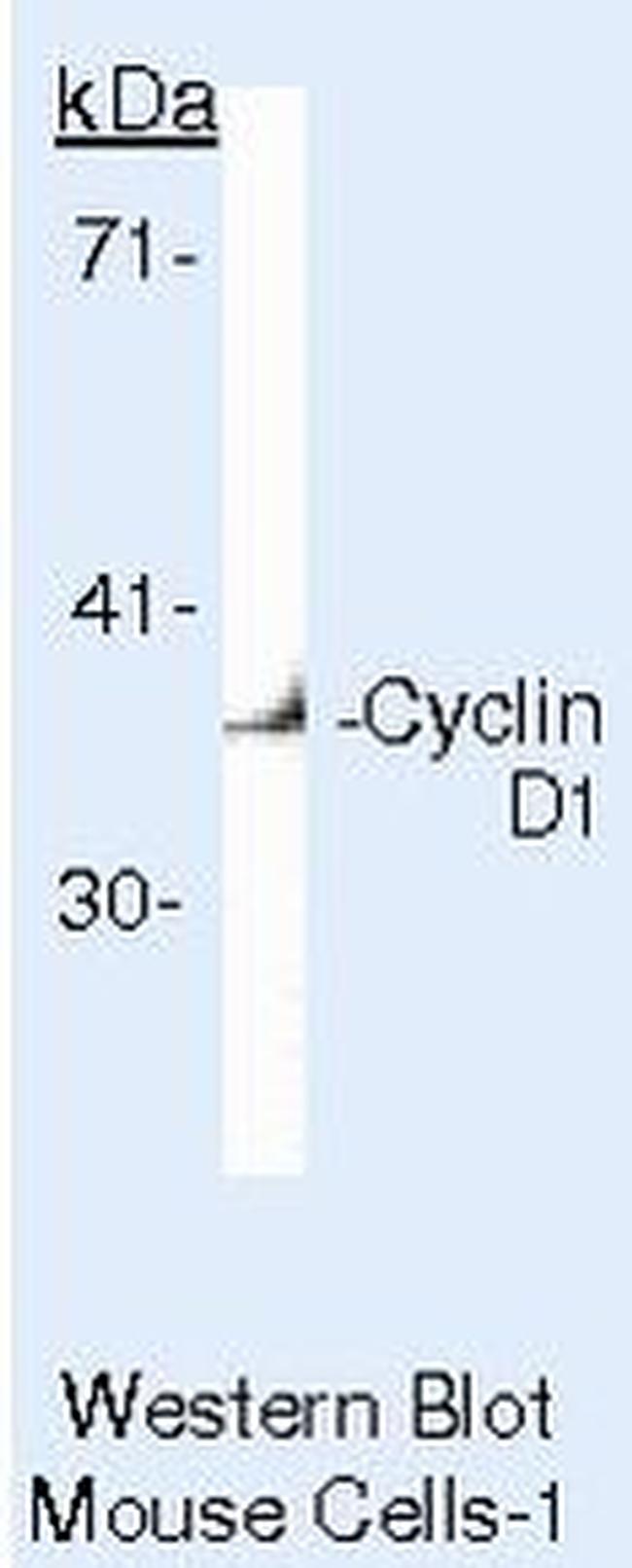 Cyclin D1 Antibody in Western Blot (WB)