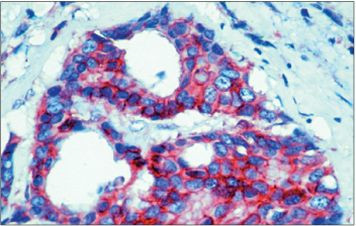 beta Catenin Antibody in Immunohistochemistry (Paraffin) (IHC (P))