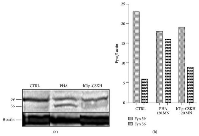 Fyn Antibody in Western Blot (WB)