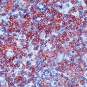 Fyn Antibody in Immunohistochemistry (Paraffin) (IHC (P))