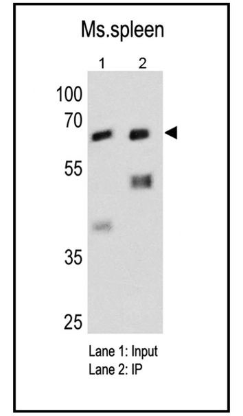 Fyn Antibody in Immunoprecipitation (IP)