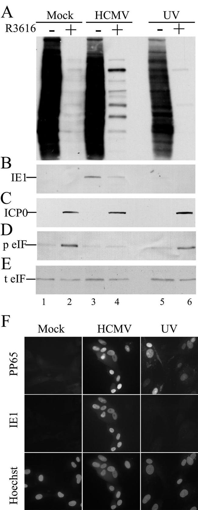 EIF2S1 Antibody in Western Blot (WB)