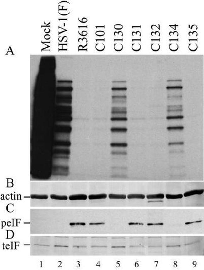 EIF2S1 Antibody in Western Blot (WB)