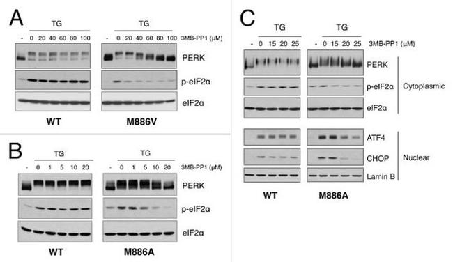 EIF2S1 Antibody in Western Blot (WB)