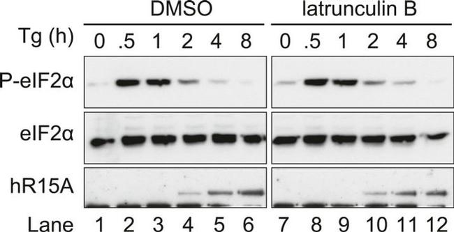 EIF2S1 Antibody in Western Blot (WB)