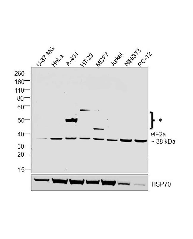 EIF2S1 Antibody in Western Blot (WB)