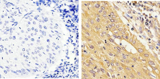 STAT1 Antibody in Immunohistochemistry (Paraffin) (IHC (P))