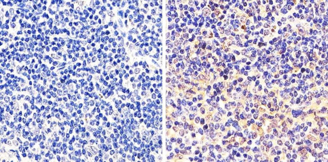 STAT1 Antibody in Immunohistochemistry (Paraffin) (IHC (P))