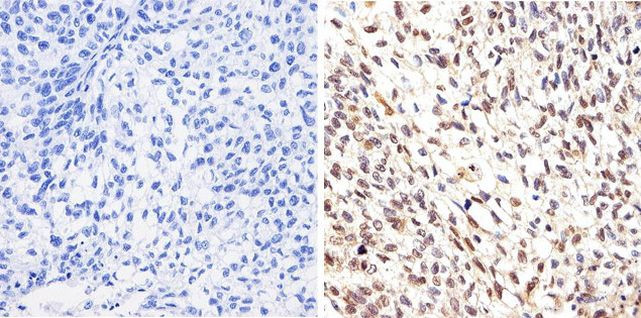 AKT1 Antibody in Immunohistochemistry (Paraffin) (IHC (P))