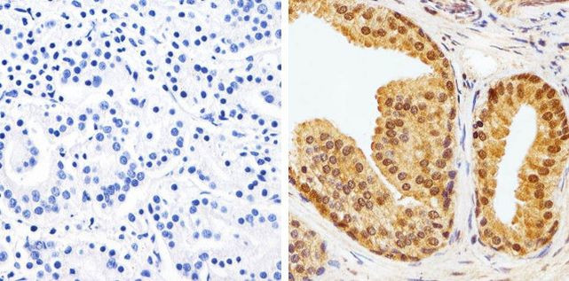 AKT1 Antibody in Immunohistochemistry (Paraffin) (IHC (P))