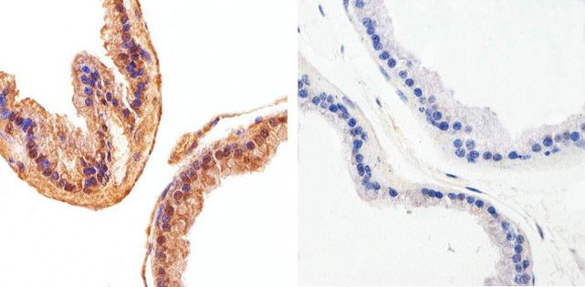 AKT1 Antibody in Immunohistochemistry (Paraffin) (IHC (P))