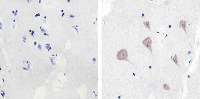 SRC Antibody in Immunohistochemistry (Paraffin) (IHC (P))