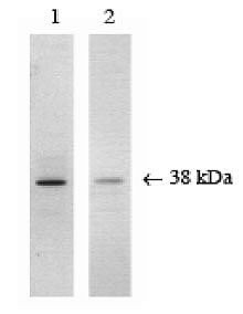 p38 MAPK Antibody in Western Blot (WB)