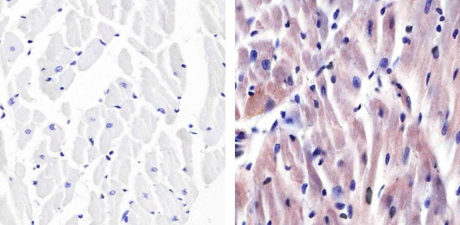 p38 MAPK Antibody in Immunohistochemistry (Paraffin) (IHC (P))