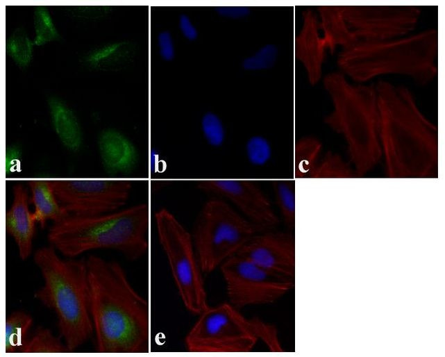 mTOR Antibody in Immunocytochemistry (ICC/IF)