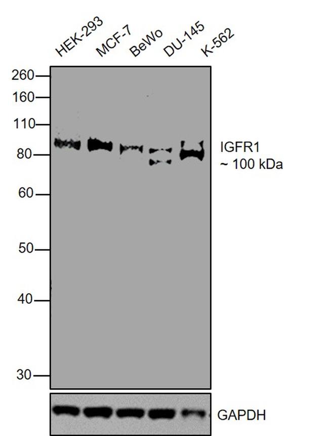 IGF1R beta Antibody in Western Blot (WB)