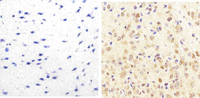 JNK1/JNK2 Antibody in Immunohistochemistry (Paraffin) (IHC (P))