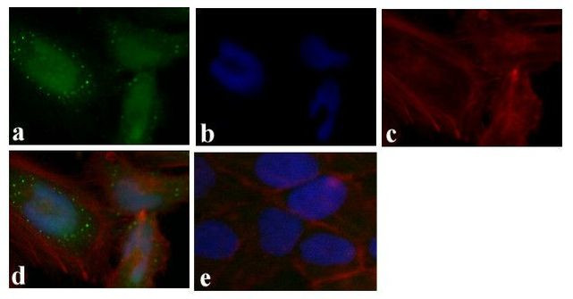 4EBP1 Antibody in Immunocytochemistry (ICC/IF)