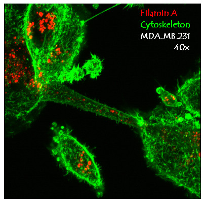Filamin A Antibody in Immunocytochemistry (ICC/IF)