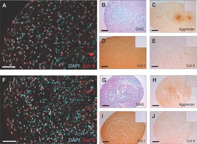 Aggrecan Antibody in Immunohistochemistry (IHC)